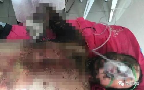 如皋医院爆料烧伤视频